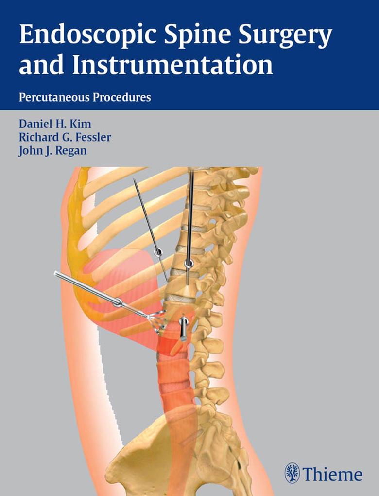 Produktbild: Endoscopic Spine Surgery and Instrumentation
