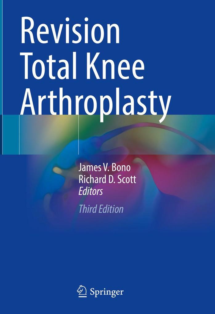 Produktbild: Revision Total Knee Arthroplasty