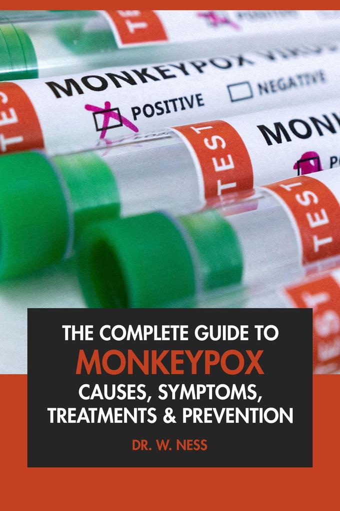 Produktbild: The Complete Guide to Monkeypox: Causes, Symptoms, Treatment & Prevention. | W. Ness
