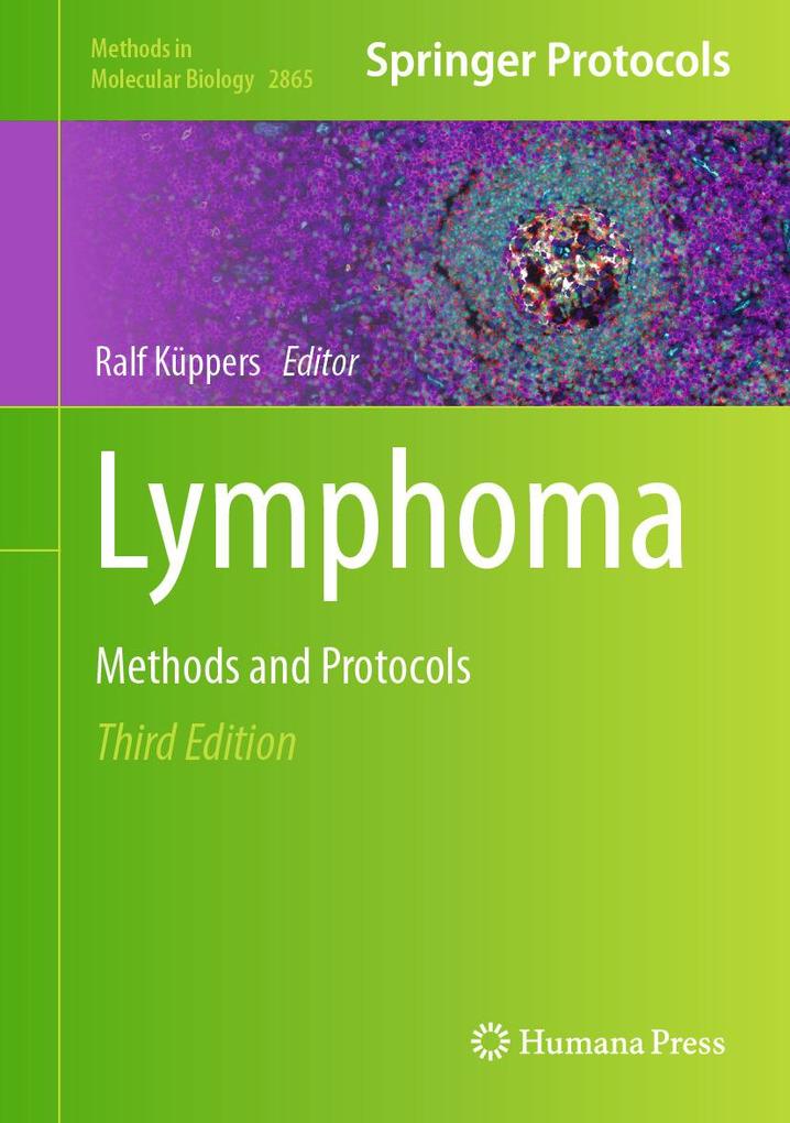 Produktbild: Lymphoma
