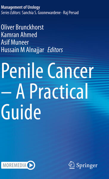 Produktbild: Penile Cancer - A Practical Guide