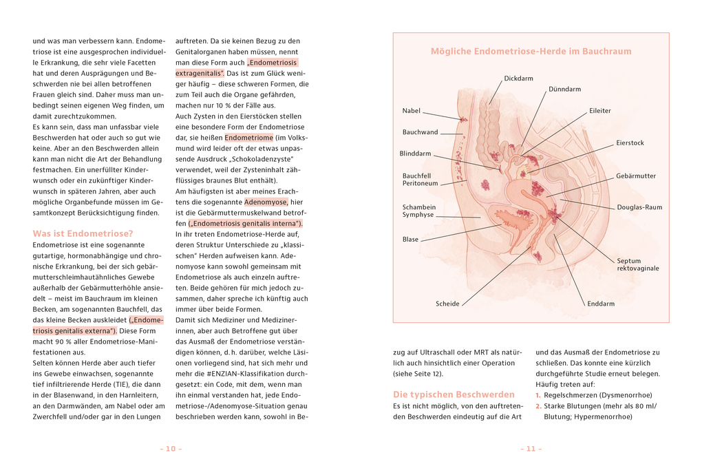 Weitere Ansicht: Endometriose - was tun? | Sylvia Mechsner