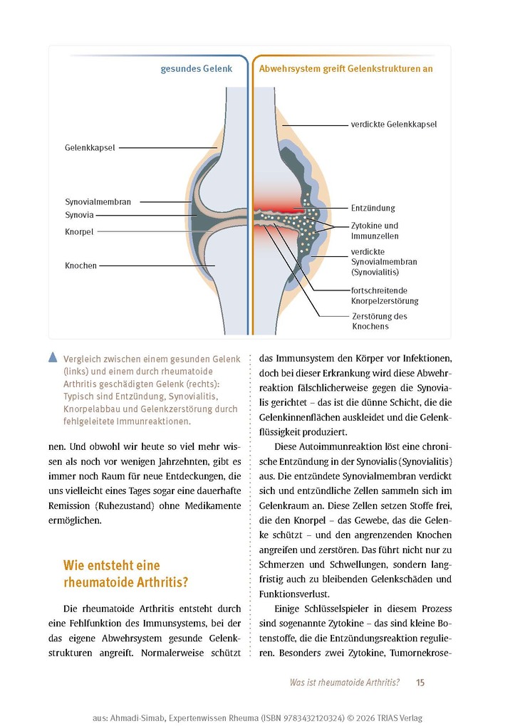 Weitere Ansicht: Expertenwissen: Rheuma | Keihan Ahmadi-Simab