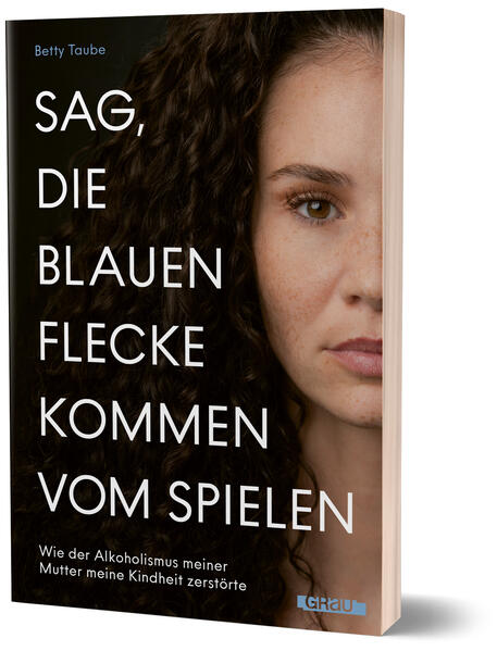 Produktbild: Sag, die blauen Flecke kommen vom Spielen | Betty Taube