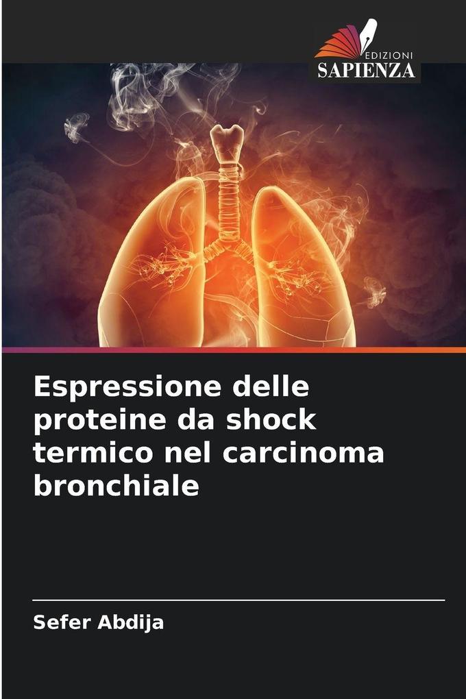 Produktbild: Espressione delle proteine da shock termico nel carcinoma bronchiale | Sefer Abdija