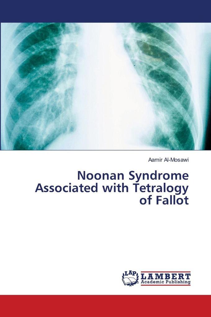 Produktbild: Noonan Syndrome Associated with Tetralogy of Fallot | Aamir Al-Mosawi