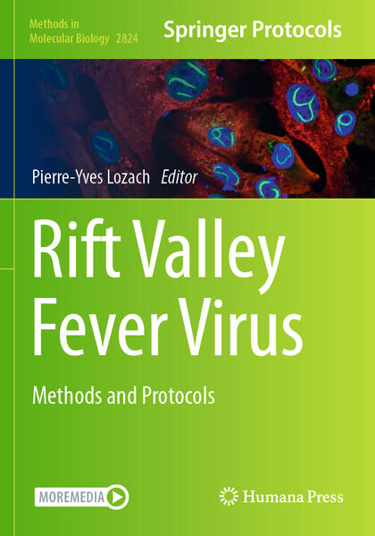 Produktbild: Rift Valley Fever Virus