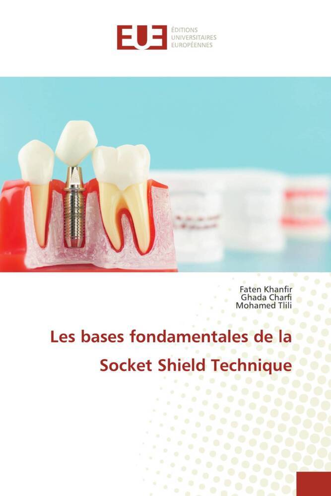 Produktbild: Les bases fondamentales de la Socket Shield Technique | Faten Khanfir, Ghada Charfi, Mohamed Tlili