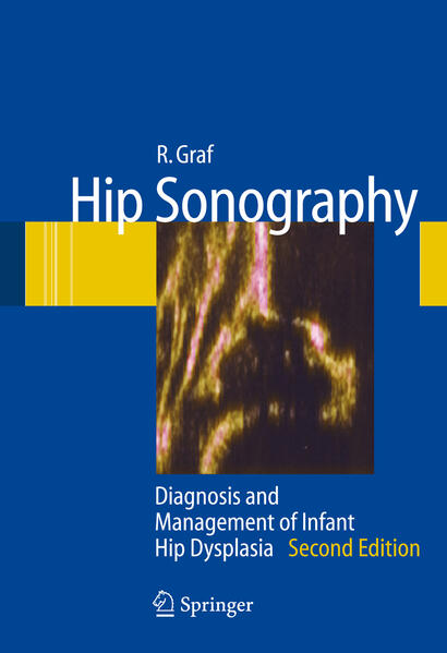 Produktbild: Hip Sonography | R. Graf