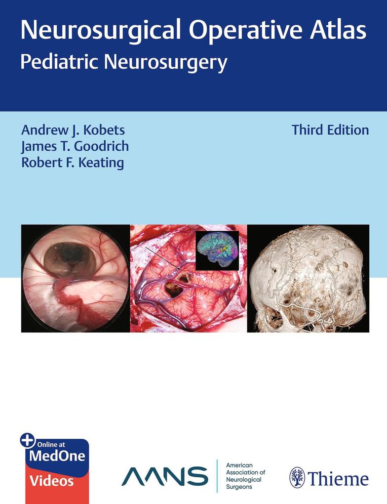 Produktbild: Neurosurgical Operative Atlas: Pediatric Neurosurgery