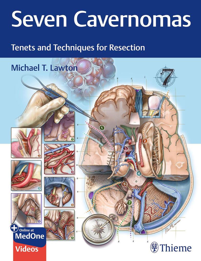 Produktbild: Seven Cavernomas | Michael T. Lawton