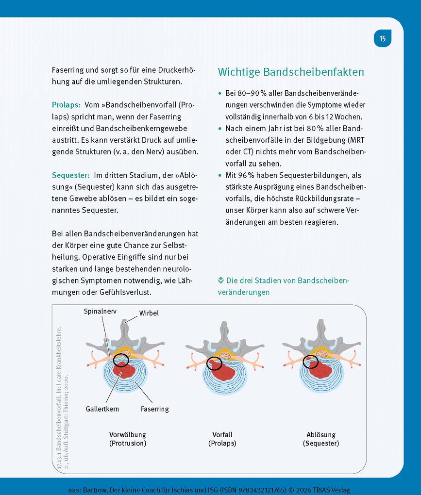 Weitere Ansicht: Der kleine Coach für Ischias und ISG | Kay Bartrow