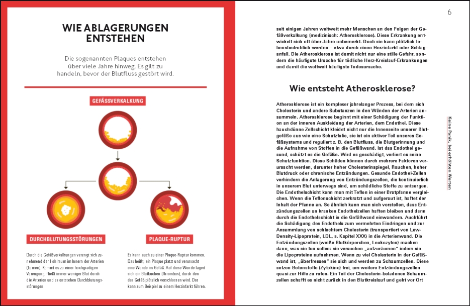 Weitere Ansicht: Runter mit dem Cholesterin | Ulrich Laufs