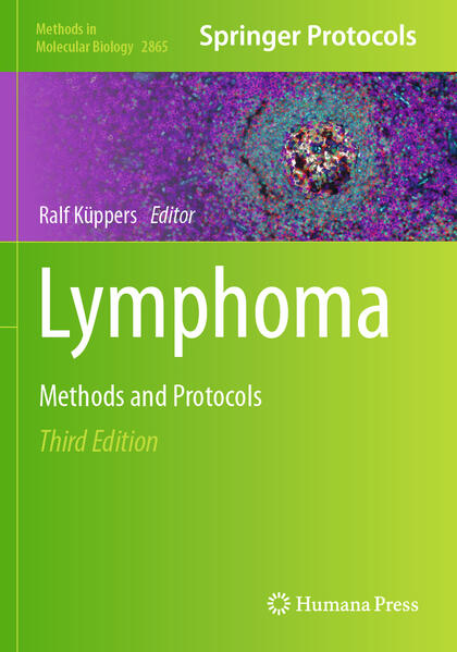 Produktbild: Lymphoma