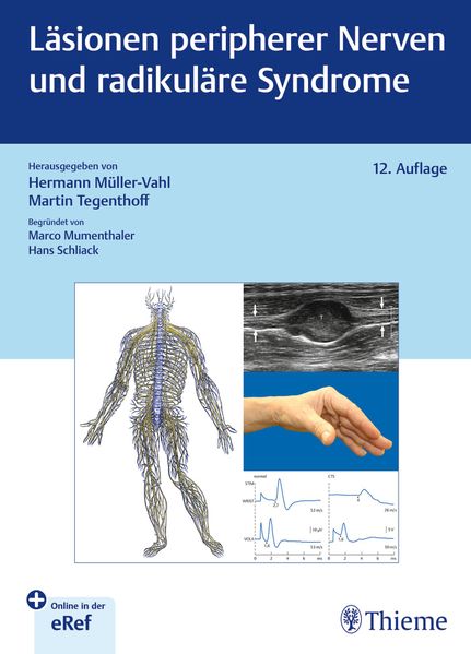 Produktbild: Läsionen peripherer Nerven und radikuläre Syndrome
