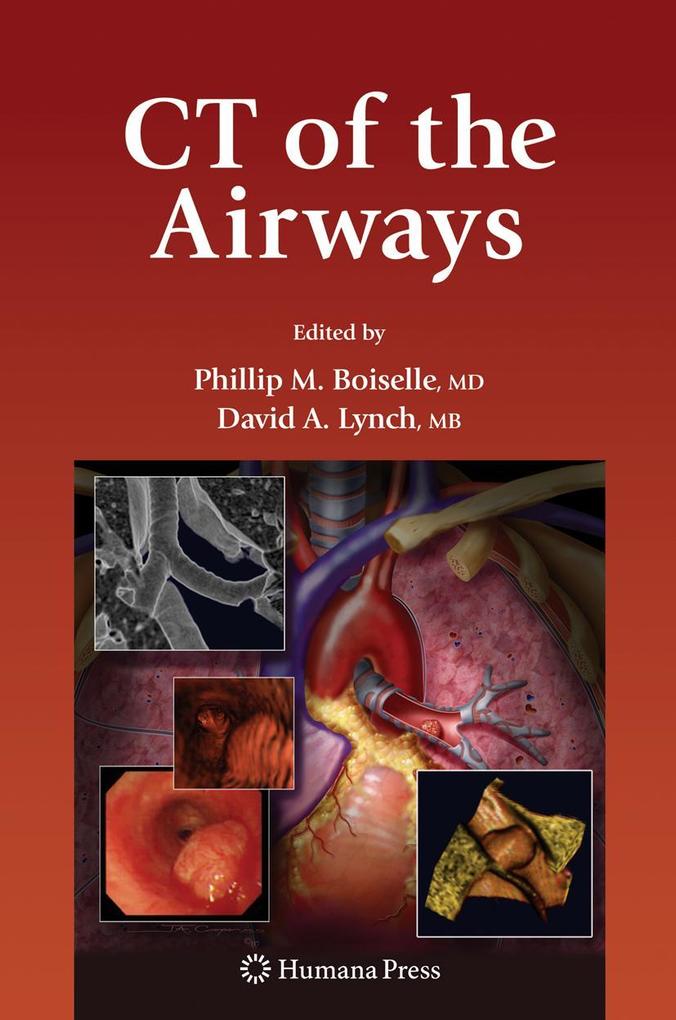 Produktbild: CT of the Airways