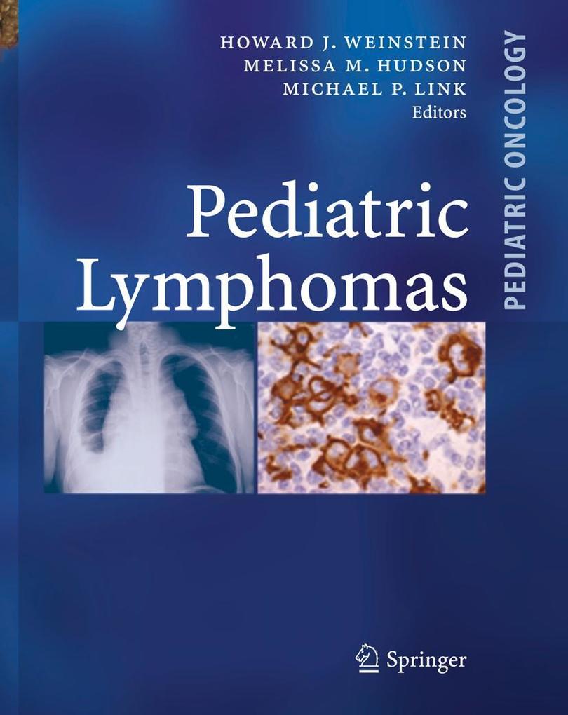 Produktbild: Pediatric Lymphomas