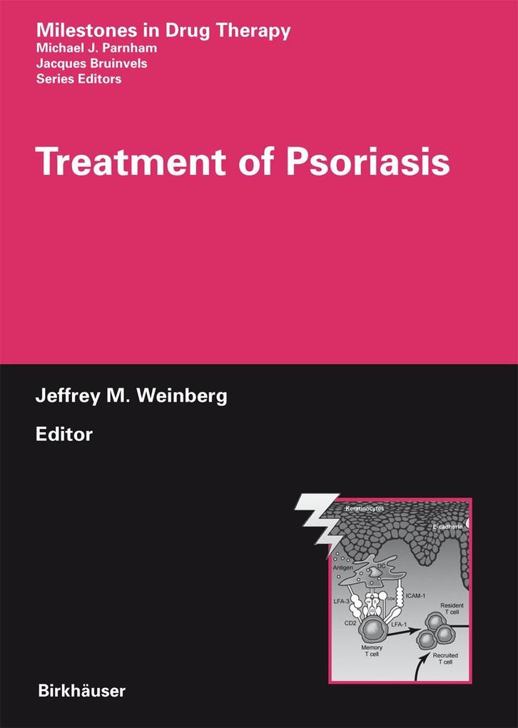 Produktbild: Treatment of Psoriasis