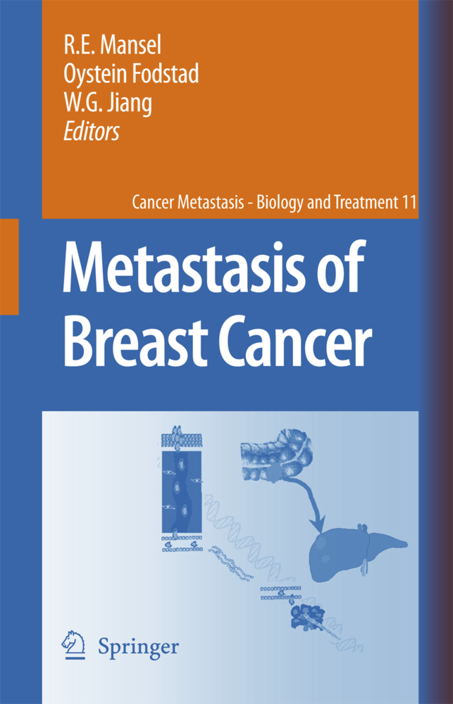 Produktbild: Metastasis of Breast Cancer