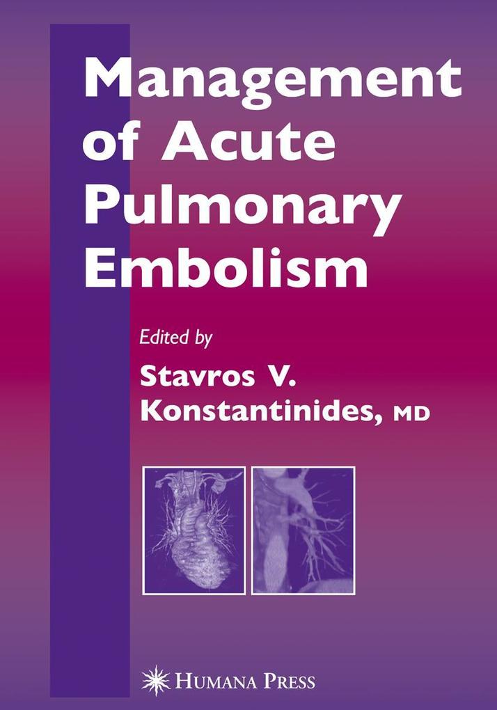 Produktbild: Management of Acute Pulmonary Embolism | S.Z. Goldhaber