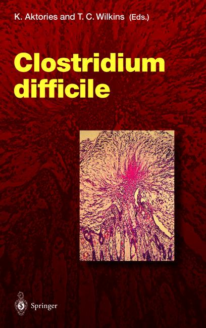 Weitere Ansicht: Clostridium difficile