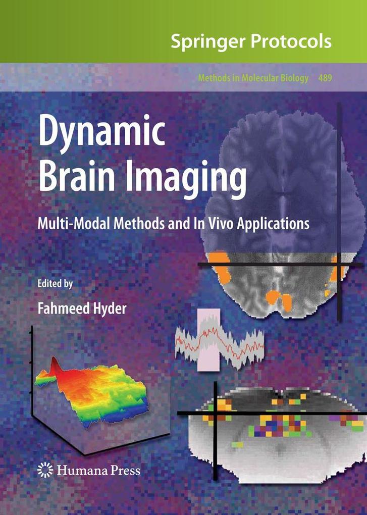 Produktbild: Dynamic Brain Imaging
