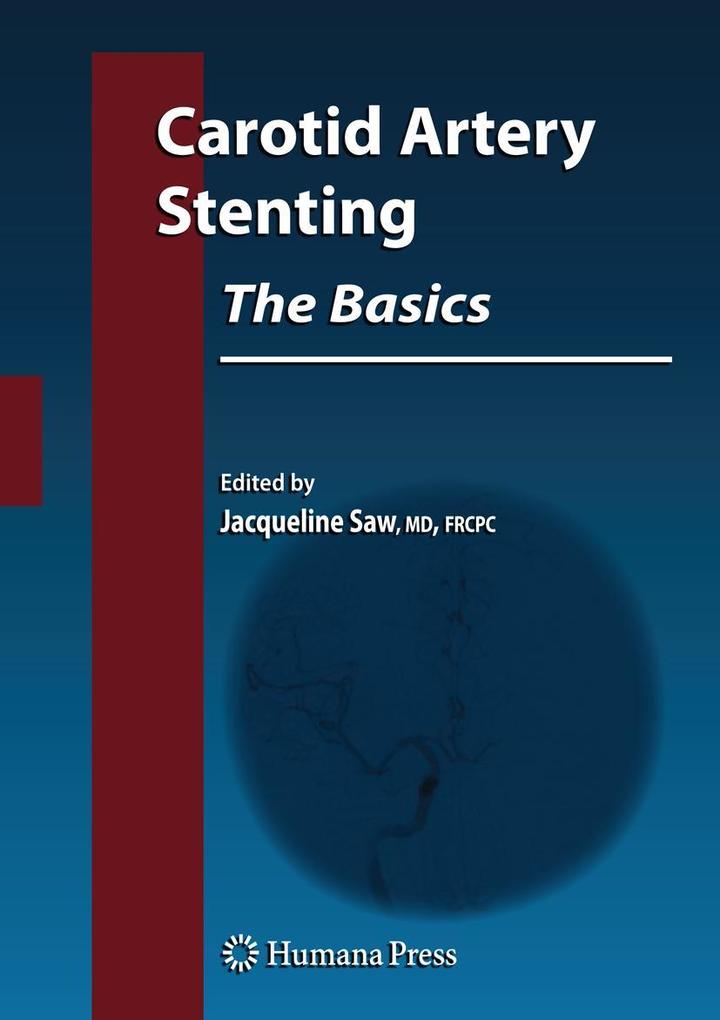 Produktbild: Carotid Artery Stenting: The Basics
