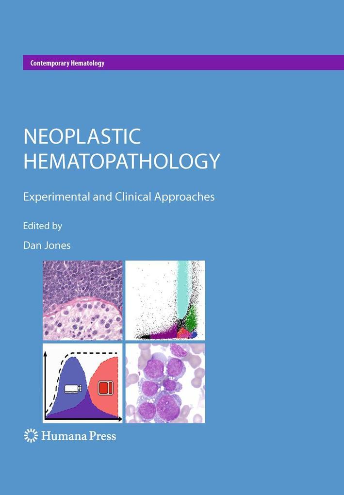 Produktbild: Neoplastic Hematopathology