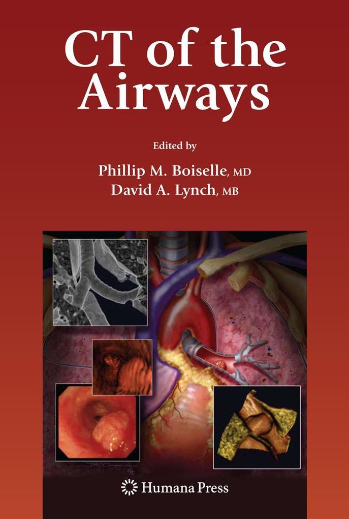 Produktbild: CT of the Airways