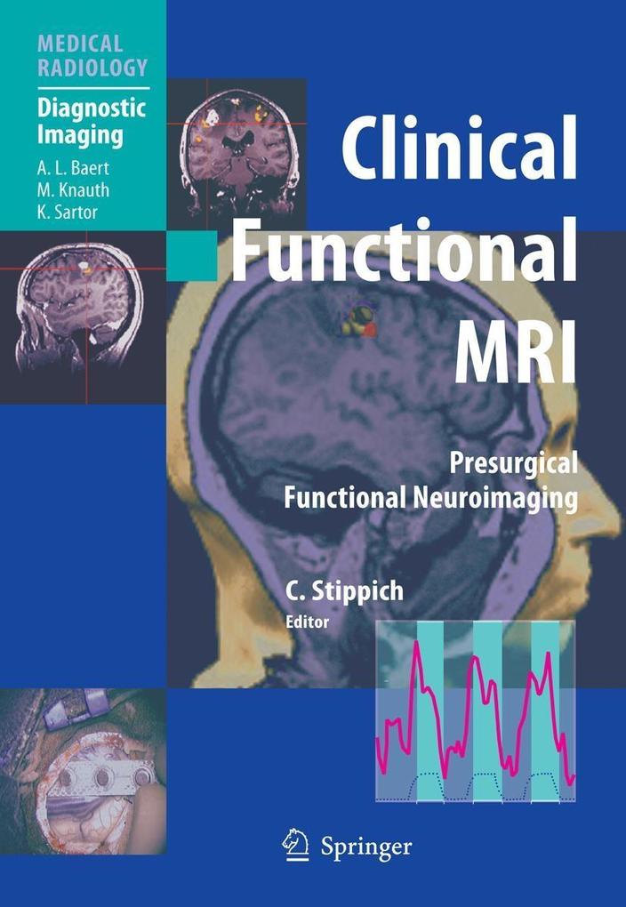 Produktbild: Clinical Functional MRI