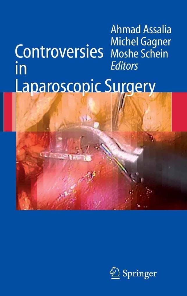 Produktbild: Controversies in Laparoscopic Surgery