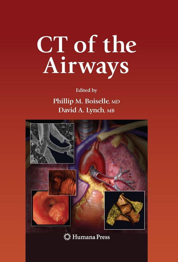 Produktbild: CT of the Airways