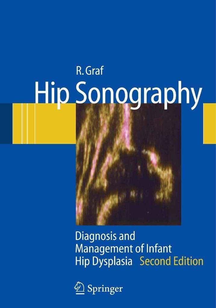 Produktbild: Hip Sonography | R. Graf